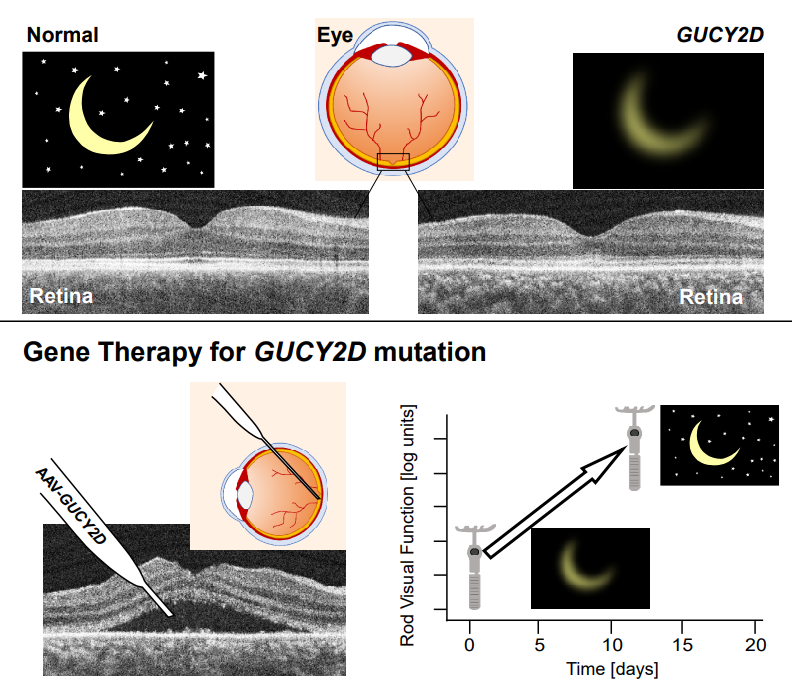 A digital illustration of normal night vision and gene therapy procedure impact